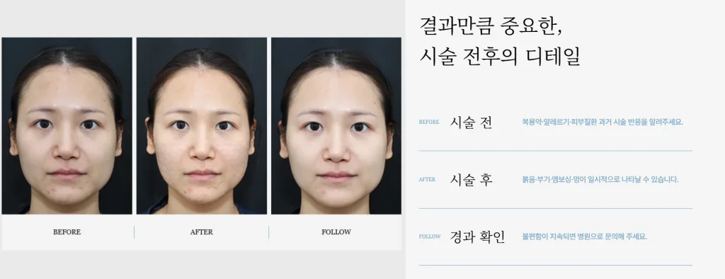 리쥬란잘하는곳